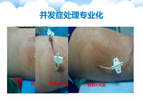 急救电话